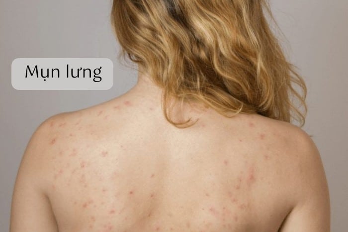 mun lung