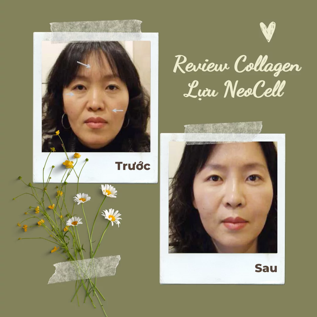 review collagen luu neocell