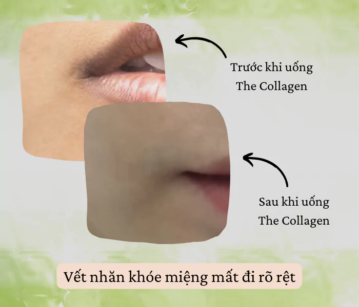 review the collagen vet nhan